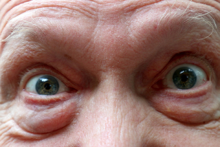 olhos reformas